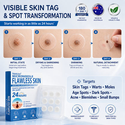 👩‍⚕️💎 𝐎𝐟𝐟𝐢𝐜𝐢𝐚𝐥 𝐒𝐭𝐨𝐫𝐞 | 𝑵𝐞𝒌𝐢𝐬𝐬® 🌿 𝐁𝐨𝐭𝐚𝐧𝐢𝐜𝐚𝐥 𝐌𝐢𝐜𝐫𝐨𝐧𝐞𝐞𝐝𝐥𝐞 𝐇𝐲𝐝𝐫𝐨𝐜𝐨𝐥𝐥𝐨𝐢𝐝 𝐏𝐚𝐭𝐜𝐡 (𝐅𝐨𝐫 𝐒𝐤𝐢𝐧 𝐓𝐚𝐠𝐬, 𝐒𝐦𝐚𝐥𝐥 𝐒𝐤𝐢𝐧 𝐆𝐫𝐨𝐰𝐭𝐡𝐬, 𝐖𝐚𝐫𝐭𝐬, 𝐌𝐨𝐥𝐞𝐬, 𝐀𝐠𝐞 𝐒𝐩𝐨𝐭𝐬 & 𝐏𝐢𝐠𝐦𝐞𝐧𝐭𝐚𝐭𝐢𝐨𝐧 𝐂𝐨𝐧𝐜𝐞𝐫𝐧𝐬)