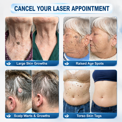 👩‍⚕️💎 𝐎𝐟𝐟𝐢𝐜𝐢𝐚𝐥 𝐒𝐭𝐨𝐫𝐞 | 𝑵𝐞𝒌𝐢𝐬𝐬® 🌿 𝐁𝐨𝐭𝐚𝐧𝐢𝐜𝐚𝐥 𝐌𝐢𝐜𝐫𝐨𝐧𝐞𝐞𝐝𝐥𝐞 𝐇𝐲𝐝𝐫𝐨𝐜𝐨𝐥𝐥𝐨𝐢𝐝 𝐏𝐚𝐭𝐜𝐡 (𝐅𝐨𝐫 𝐒𝐤𝐢𝐧 𝐓𝐚𝐠𝐬, 𝐒𝐦𝐚𝐥𝐥 𝐒𝐤𝐢𝐧 𝐆𝐫𝐨𝐰𝐭𝐡𝐬, 𝐖𝐚𝐫𝐭𝐬, 𝐌𝐨𝐥𝐞𝐬, 𝐀𝐠𝐞 𝐒𝐩𝐨𝐭𝐬 & 𝐏𝐢𝐠𝐦𝐞𝐧𝐭𝐚𝐭𝐢𝐨𝐧 𝐂𝐨𝐧𝐜𝐞𝐫𝐧𝐬)